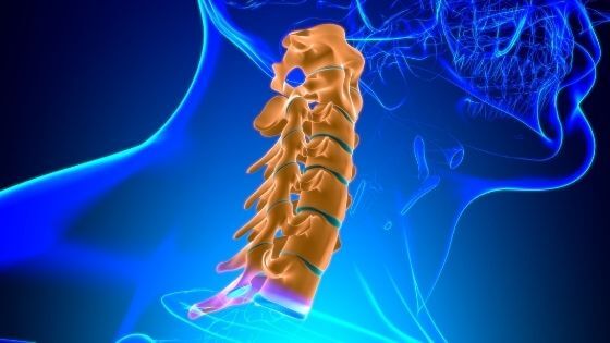 Myélopathie cervicarthrosique