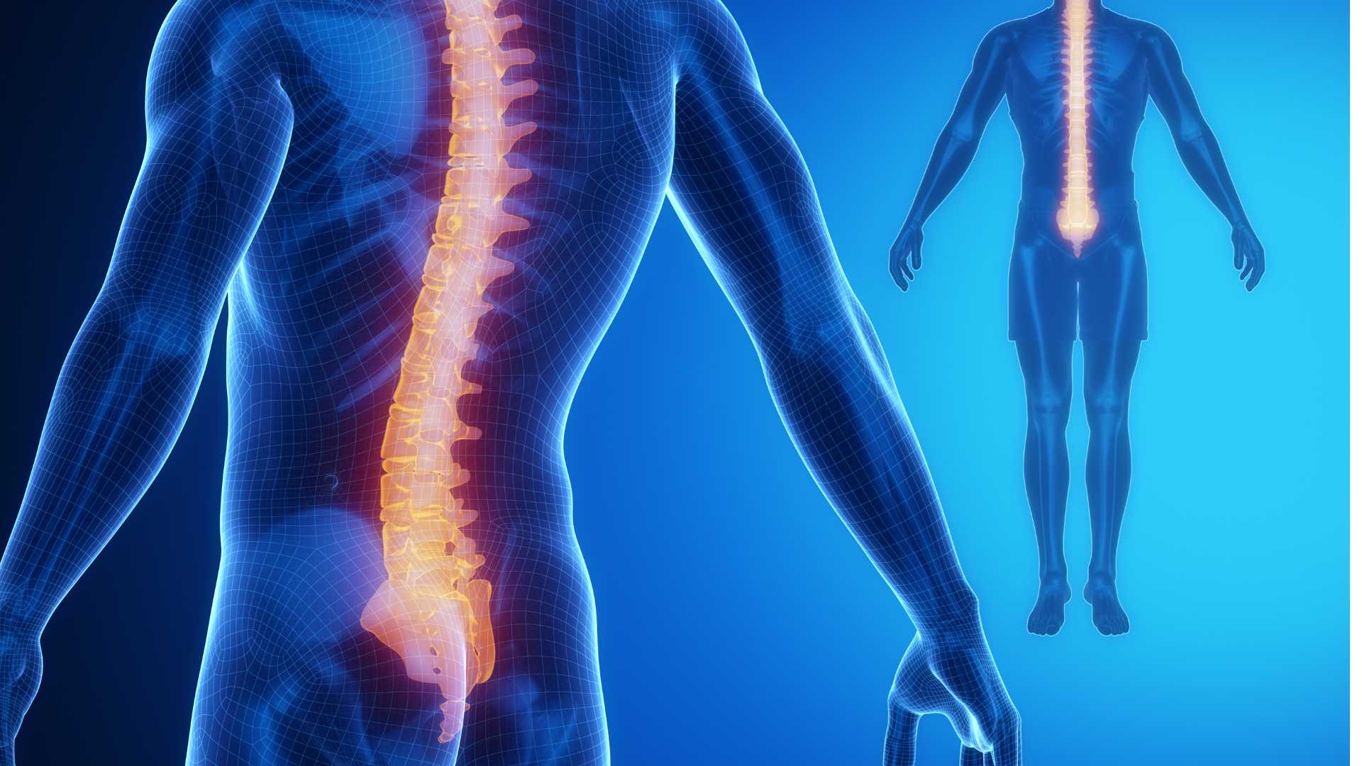 Qu’est-ce que la syringomyélie et comment la traiter ?